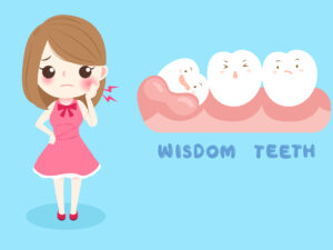 Denti del giudizio: estrazione, sintomi e consigli