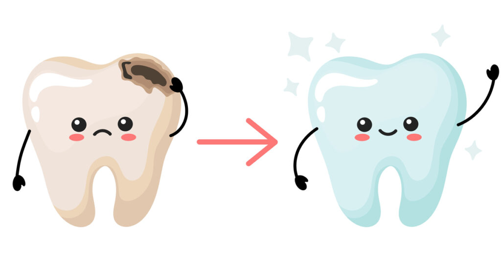 devitalizzazione dentaria