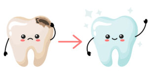 devitalizzazione dentaria