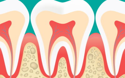 Dentina: cos’è e a cosa serve