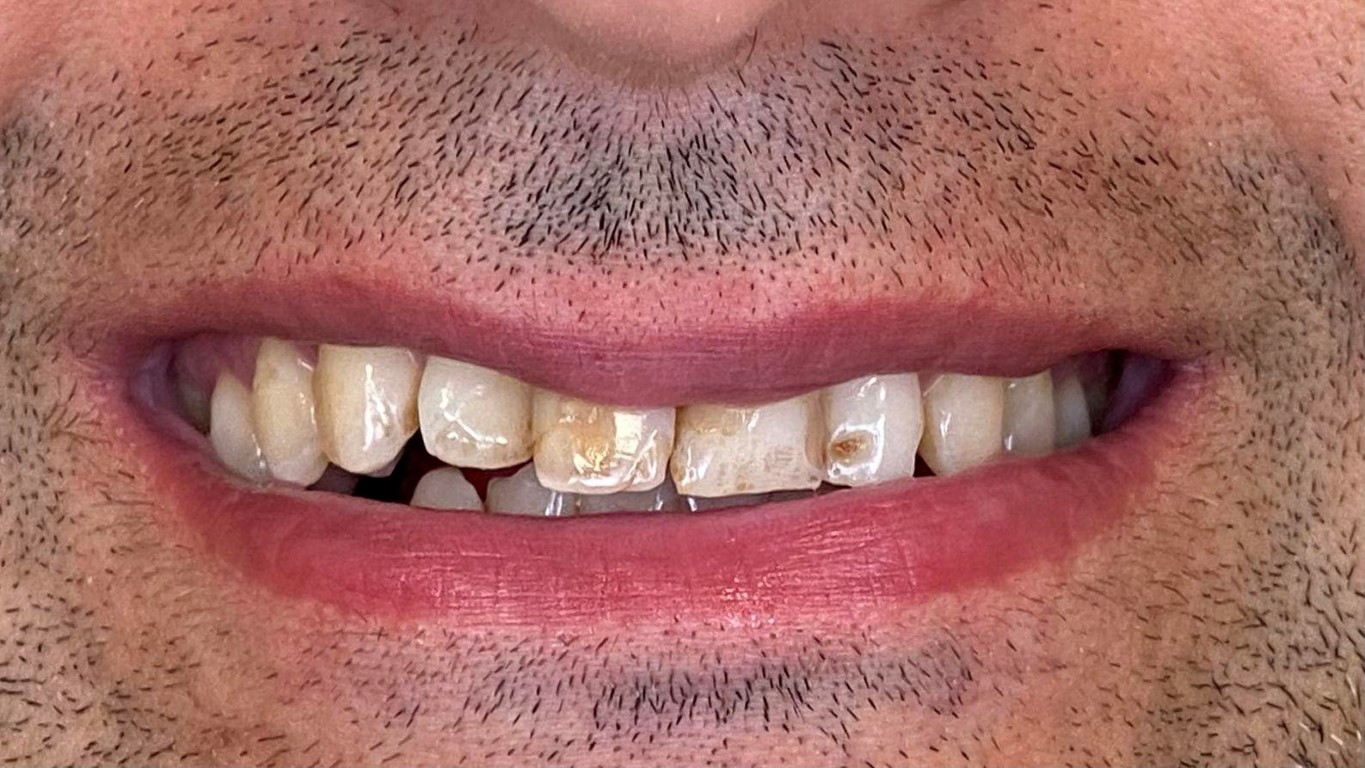 31065__20240910-131048