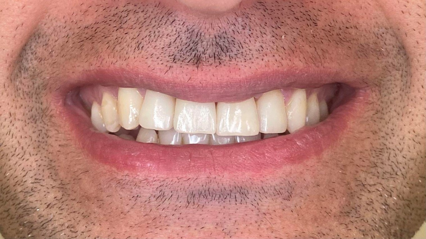 31182__20240919-125235