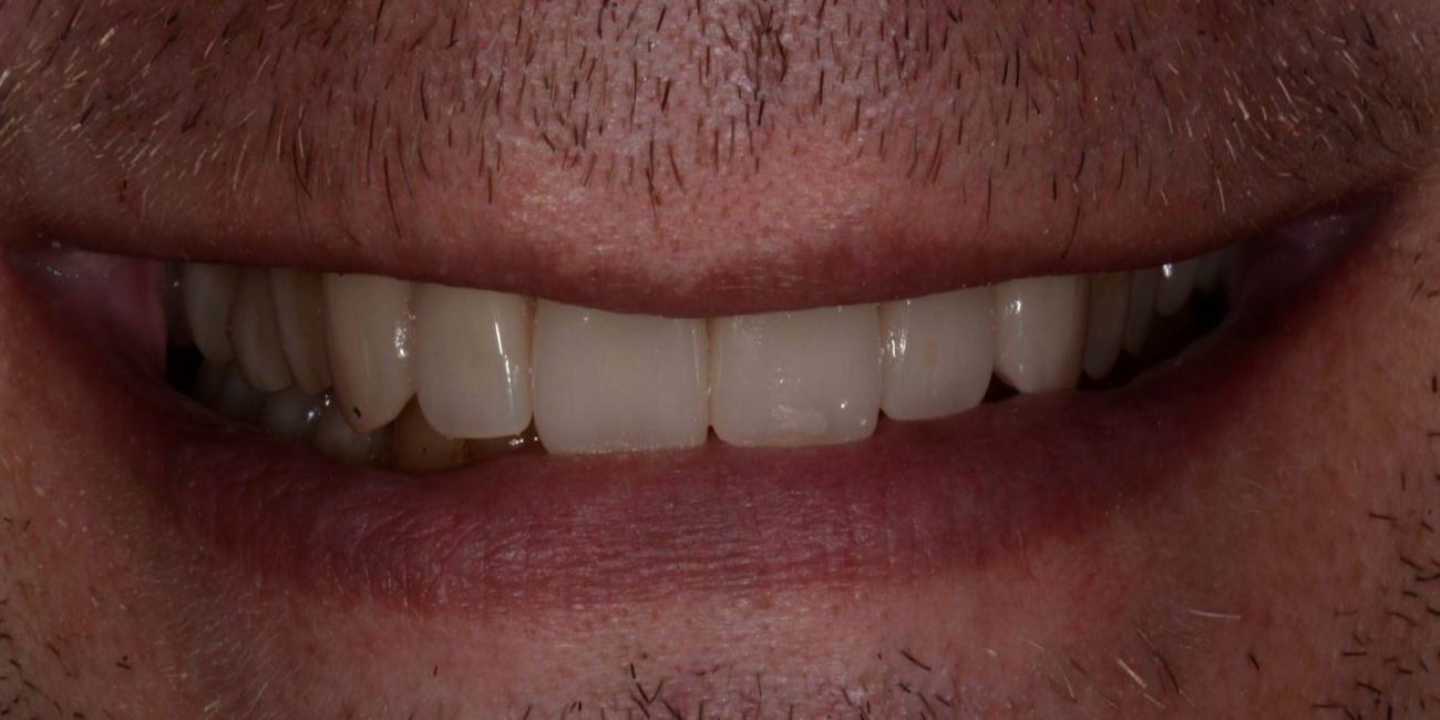 9503-151733